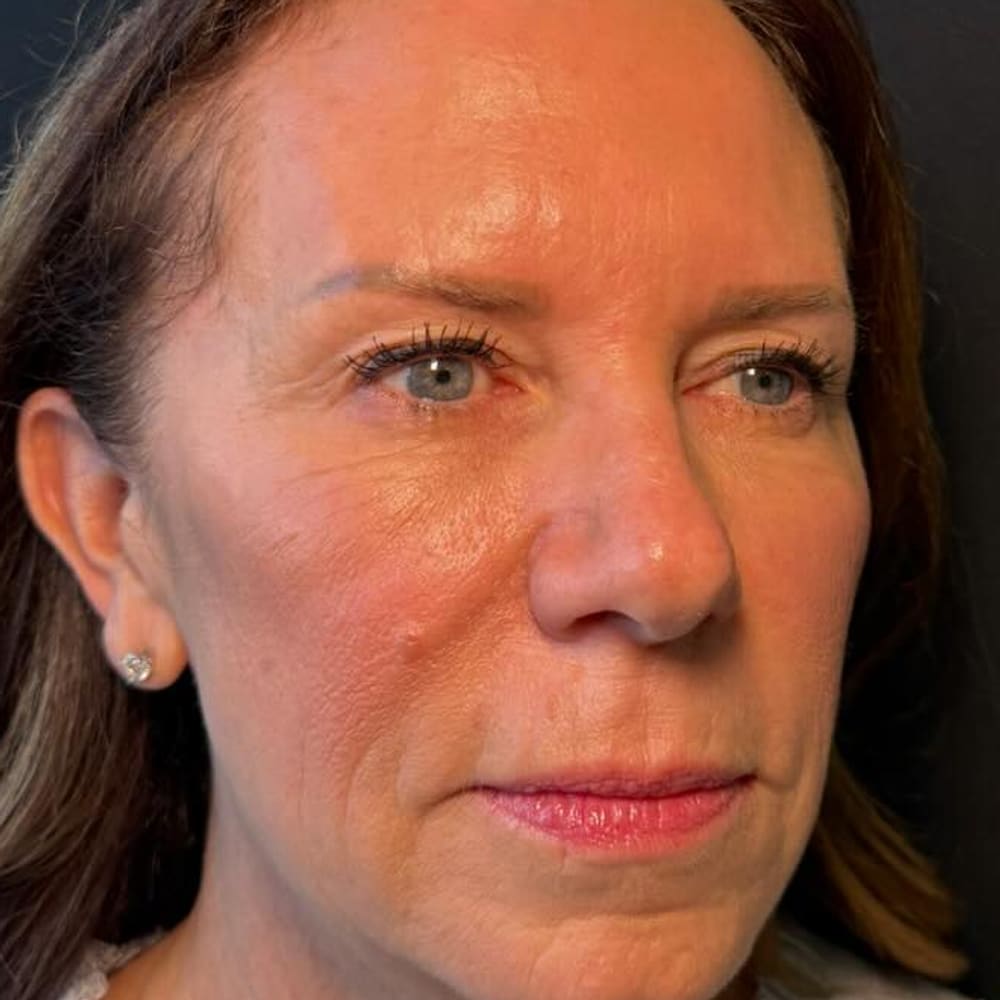 Facial balancing, before treatment
