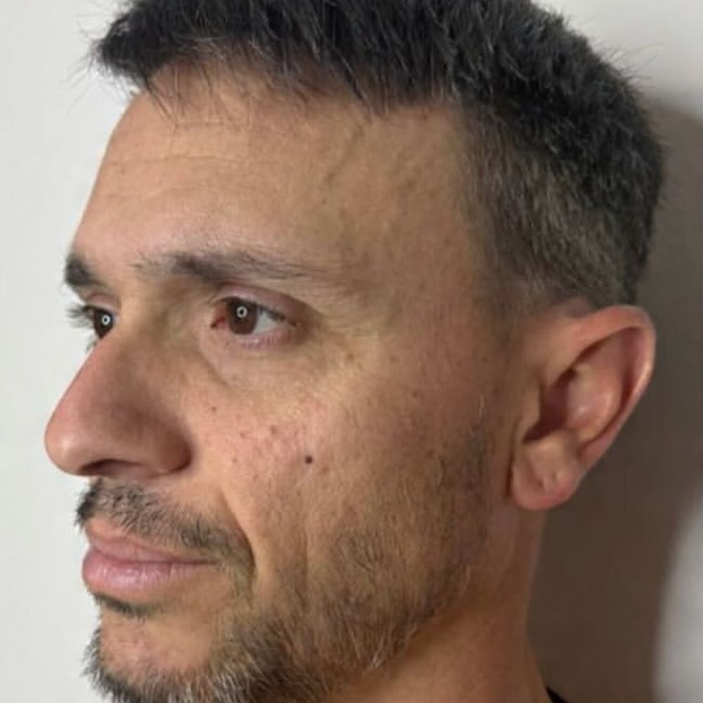 Profile balancing before treatment