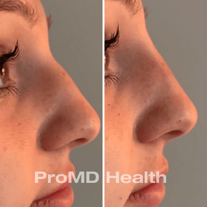 Facial balancing treatment area